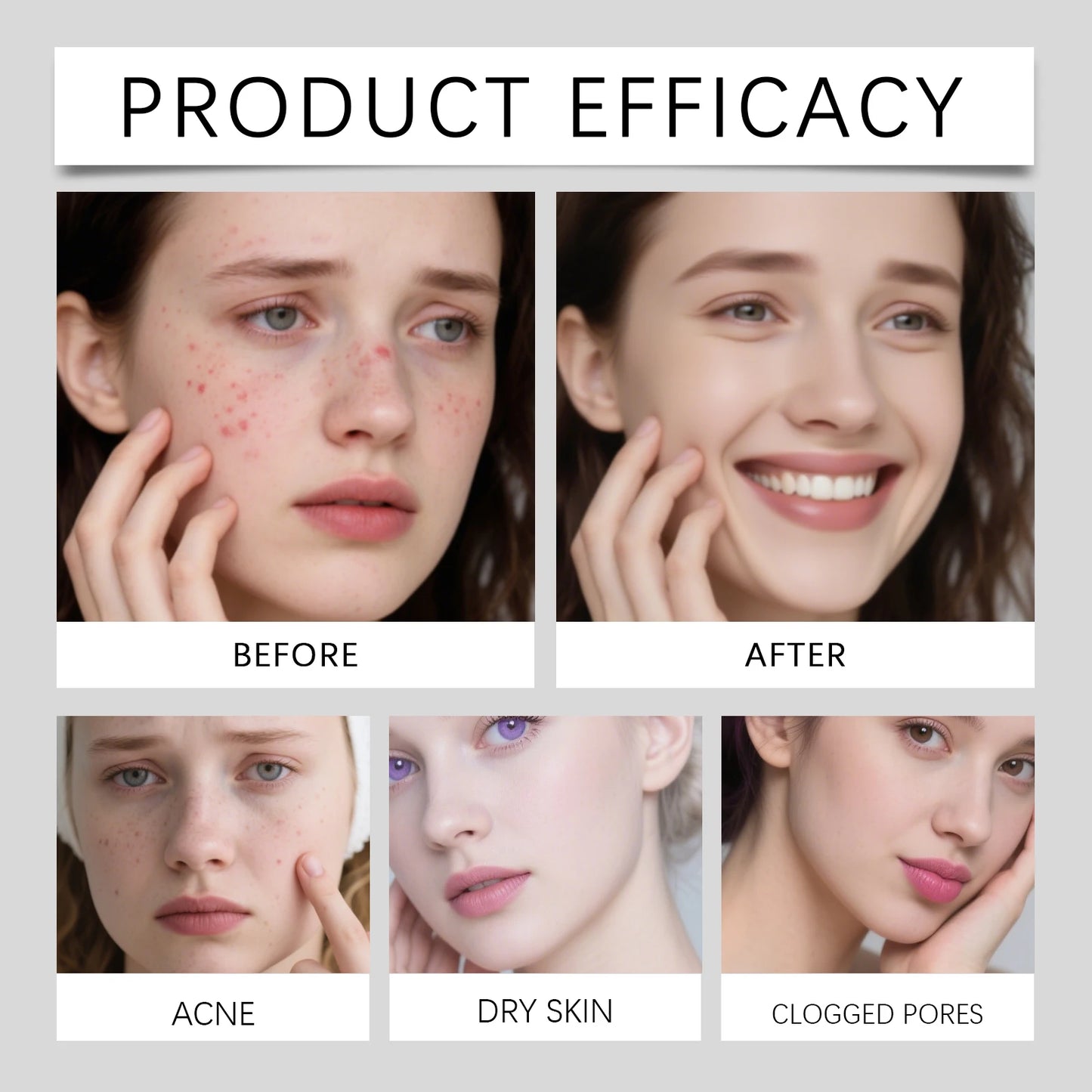 Tea Tree Oil Acne Patches with Salicylic Acid Hyaluronic Acid Gentle Skin Patches Breathable Invisible Wear 144pcs Daily Use